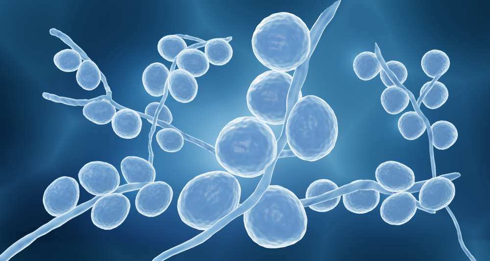 Yeast Infection Symptoms